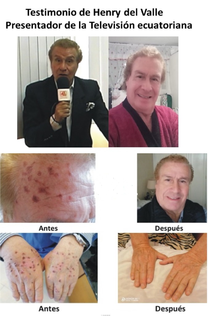 Testimonio de Henry del Valle - Antes y Después